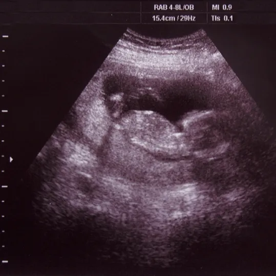 Fetal ultrasound image relevant to medical negligence or misdiagnosis